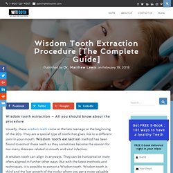 Wisdom Tooth Extraction Procedure [The Complete Guide] - Wittooth