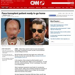 Face transplant patient ready to go home