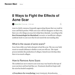 8 Ways to Fight the Effects of Acne Scar