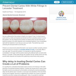 Prevent Dental Caries With White Fillings In Leicester Treatment