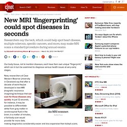 New MRI 'fingerprinting' could spot diseases in seconds