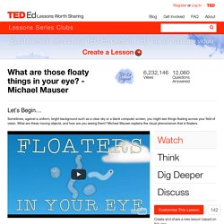 What are those floaty things in your eye? - Michael Mauser