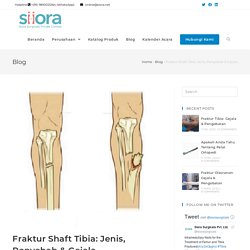 Fraktur Shaft Tibia: Jenis, Penyebab & Gejala - Siiora.co.id