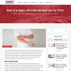 What Is A Fungal Infection And What Are Its Types?