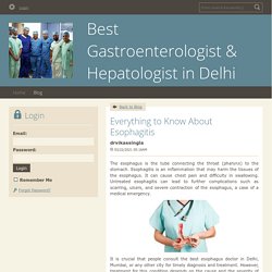 Everything to Know About Esophagitis