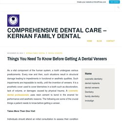 Things You Need To Know Before Getting A Dental Veneers