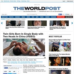 Twin Girls Born In Single Body with Two Heads In China