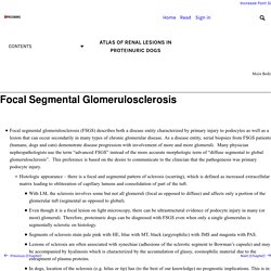 Focal Segmental Glomerulosclerosis – Atlas of Renal Lesions in Proteinuric Dogs
