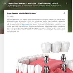 Golden Reasons to Prefer Dental Implants