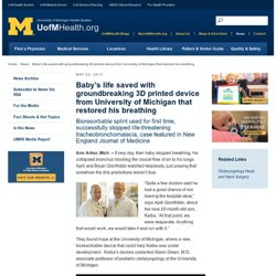 Baby’s life saved with groundbreaking 3D printed device from University of Michigan that restored his breathing