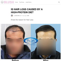 IS HAIR LOSS CAUSED BY A HIGH-PROTEIN DIET