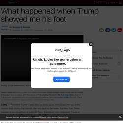 What happened when Trump showed me his foot (opinion)