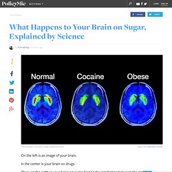 What Happens to Your Brain on Sugar, Explained by Science