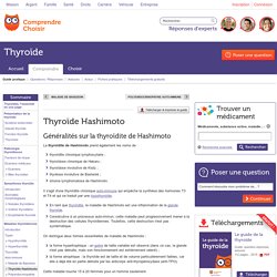 Thyroïde Hashimoto : connaître la thyroïdite de Hashimoto