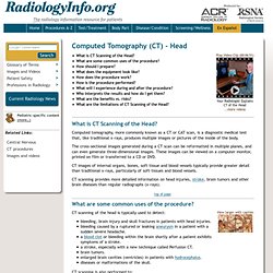 Head CT (Computed Tomography, CAT scan)