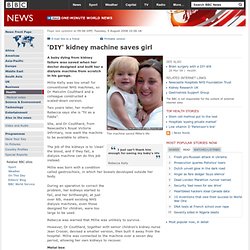 'DIY' kidney machine saves girl