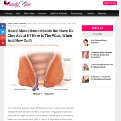 Heard About Hemorrhoids But Have No Clue About It? Here Is The What, When And How On It