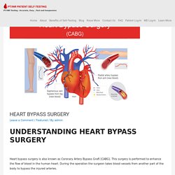 HEART BYPASS SURGERY -