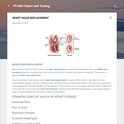 HEART VALVE REPLACEMENT