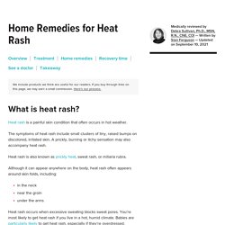 How to Get Rid of a Heat Rash: Treatment, Remedies, and More