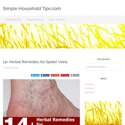 14+ Herbal Remedies for Spider Veins