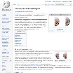 Homonymous hemianopsia