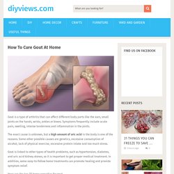 How To Cure Gout At Home