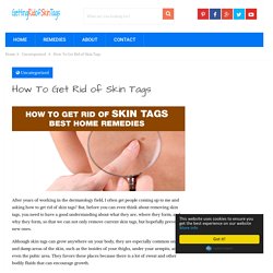 How To Get Rid of Skin Tags
