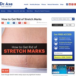 How to Get Rid of Stretch Marks - Dr. Axe
