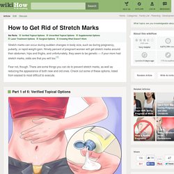 6 Ways to Get Rid of Stretch Marks