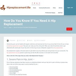 How Do You Know If You Need A Hip Replacement