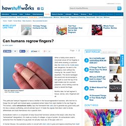 Can humans regrow fingers?"