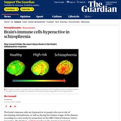 Brain’s immune cells hyperactive in schizophrenia