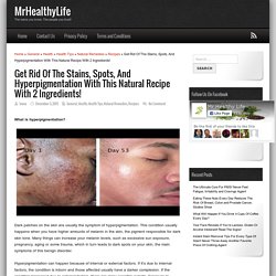 Get Rid Of The Stains, Spots, And Hyperpigmentation With This Natural Recipe With 2 Ingredients! - MrHealthyLife