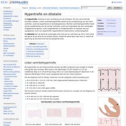 Hypertrofie en dilatatie - ECGpedia