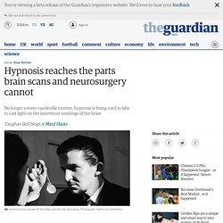 Hypnosis reaches the parts brain scans and neurosurgery cannot