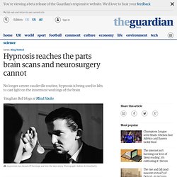 Hypnosis reaches the parts brain scans and neurosurgery cannot