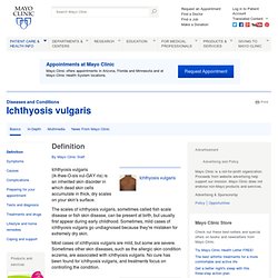 Ichthyosis vulgaris: Lifestyle and home remedies