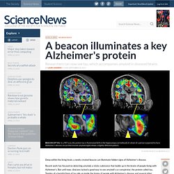 News in Brief: A beacon illuminates a key Alzheimer's protein