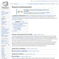 Magnétoencéphalographie