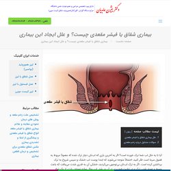 بیماری شقاق یا فیشر مقعدی چیست؟ و علل ایجاد این بیماری - ایران کلینیک