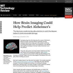 How Brain Imaging Could Help Predict Alzheimer's