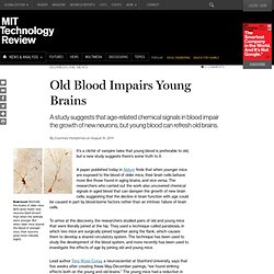 Old Blood Impairs Young Brains 