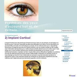 2) Implant Cortical - Prothèses des yeux d'aujourd'hui et de demain