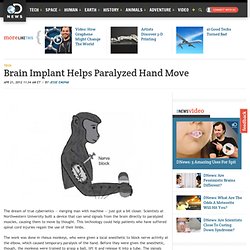 Brain Implant Helps Paralyzed Hand Move