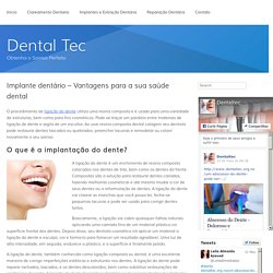 Implante dentário – Vantagens para a sua saúde dental