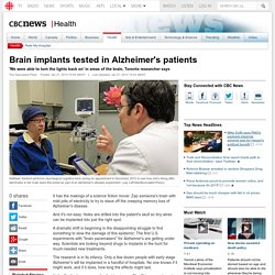 Brain implants tested in Alzheimer's patients - World