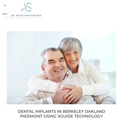 Dental Implants In Berkeley Oakland Piedmont Using XGuide Technology