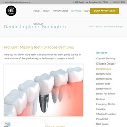 Learn Some Astonishing Benefits of Dental Implants