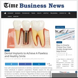 Dental Implants to Achieve A Flawless and Healthy Smile